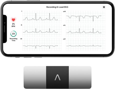 KardiaMobile Six-Lead Personal EKG Monitor Detect AFib by AliveCor