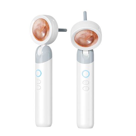 Smart Ear Camera with Screen, 2MP HD Otoscope, 12 Tips, Video & Photo Recording