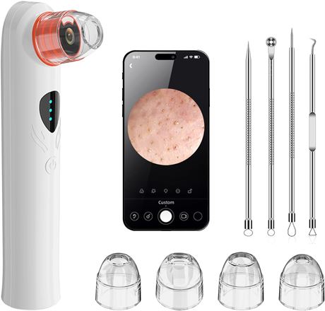 Blackhead Remover Vacuum - Pore Extractor